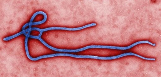 Virus ebola.
