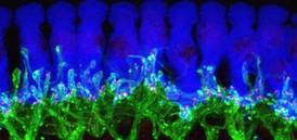 Mikrofotografie ribbon synapsí, propojujících vláskové buňky vnitřního ucha (modře) s nervovými buňkami (zeleně.).