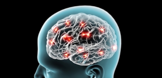 Vědci zjistili, že v mozku pacientů jsou místně zvýšené protilátky specifické právě pro alzheimera (ilustrační foto).