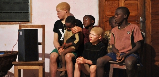 Dva albínští chlapci meziostatními ze své vesnice.