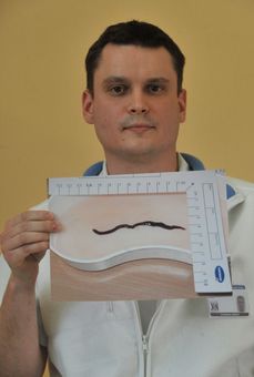 Urolog Jan Pulcer s fotografií parazita.