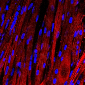 Počítačem obarvený snímek mikroskopické struktury umělého svalu.