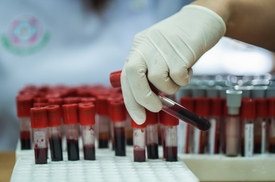 Laboratorní testování krve (ilustrační foto).