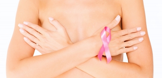 Vzhledem k tomu, že se daří objevovat nádory ve stále nižším stadiu, má ČR nyní pátou nejnižší úmrtnost žen na rakovinu prsu v Evropě (ilustrační foto).
