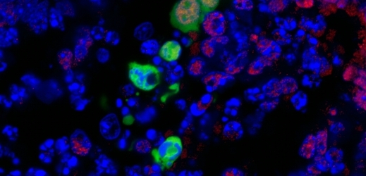 Nový druh kmenových buněk (zeleně) obklopený buňkami z myšího embrya (modře).
