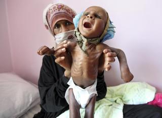 Hlad v Jemenu.