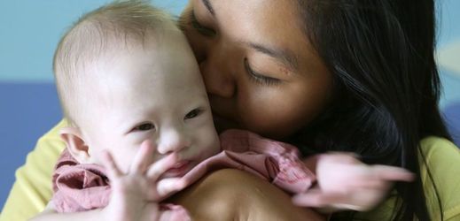 Australský pár odmítl převzít donošené dítě, protože trpí Downovým syndromem.