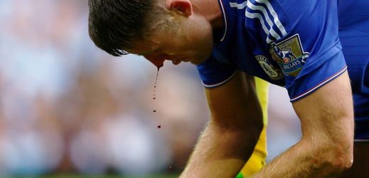 Obránce Chelsea Gary Cahill krvácí po jednom ze střetů. Hra Chelsea krvácí ale mnohem více. 