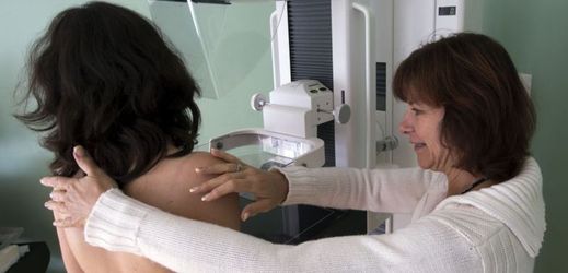 Screening rakoviny prsu u žen hradí zdravotní pojišťovna již několik let.