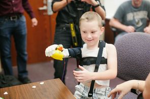 Bionické končetiny vyrobené s pomocí 3D tiskárny se již dostaly k některým dětem.
