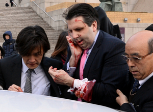 Americký velvyslanec v Soulu Mark Lippert po útoku Kim Ki-čonga.