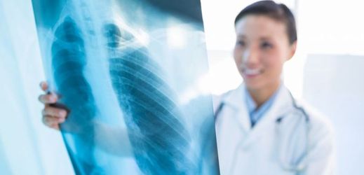 Plicní fibrózu odhalí praktický lékař.