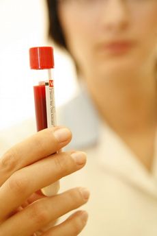 Loni vyšla léčba hemofilie pojišťovny na více než 600 milionů korun.