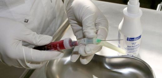 Odběr krve pro testy na HIV.