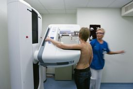 Mamografii hradí pojišťovna ženám od 45 let, ve dvouletých intervalech.