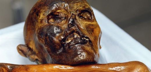 V těle Ötziho se našla agresivní forma žaludeční bakterie.