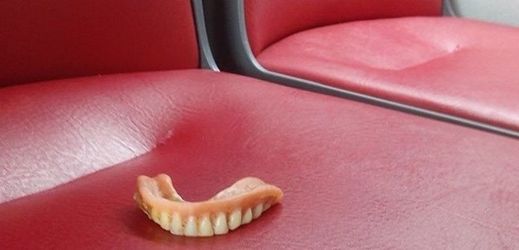 Zuby ztracené v autobuse.