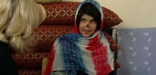 Afghánská dívka Bibi Aisha, které její manžel uřízl nos a obě uši. V roce 2010 se objevila na titulní stránce časopisu Time, 