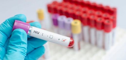 V Moravskoslezském kraji přibylo 15 nově nakažených virem HIV.