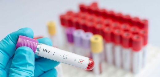 Německá organizace na pomoc lidem nakaženým virem HIV Deutsche AIDS-Hilfe vyzvala českou vládu, aby zastavila stíhání 30 HIV pozitivních mužů. 