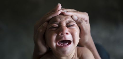 Nemocí postižené brazilské dítě.