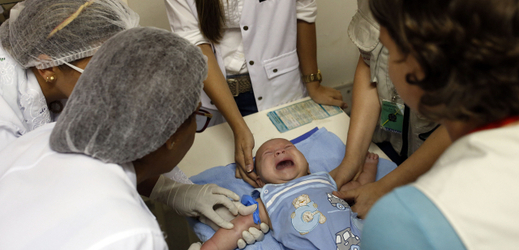 V Brazílii se objevilo téměř pět tisíc případů mikrocefalie, spojované se zikou.