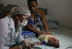 Zdravotní pracovnice odebírá vzorek krve tříměsíčnímu chlapci, který se narodil s mikrocefalií, Brazílie.