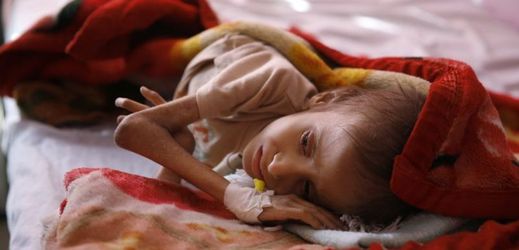 Odhadem 320 tisíc dětí je v Jemenu ohroženo podvýživou.
