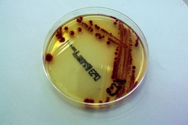 Petriho miska s bakteriemi. Spousta mikrobů se nedá takhle vypěstovat v laboratoři.