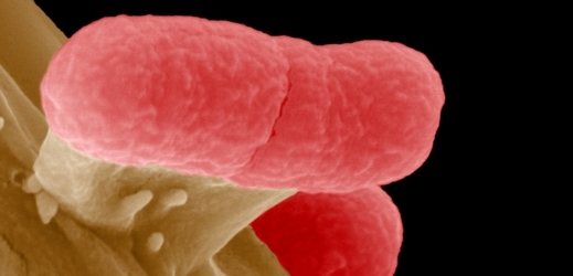 Asi nejprozkoumanější mikrob na světě je střevní tyčka Escherichia coli.