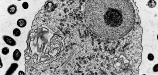 Pražští vědci objevili prvoka žijícího ve střevech obratlovců, který dokáže fungovat i bez mitochondrií.