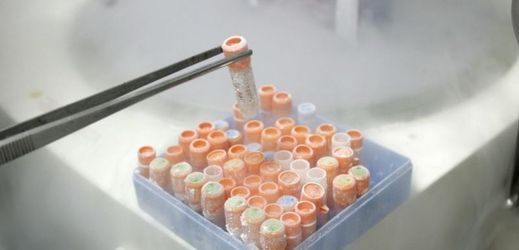 Zkumavky s kmenovými buňkami (ilustrační foto).