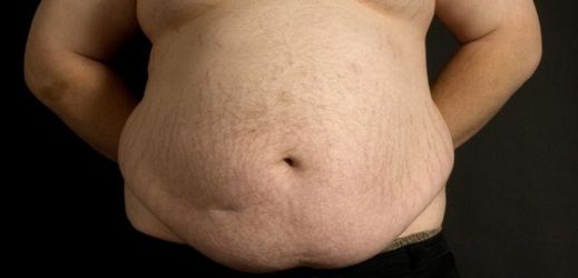 Podle statistik WHO trpí nadváhou 1,3 miliardy dospělých lidí.