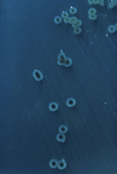 Kolonie bakterie Salmonella enterica na misce s živinami.