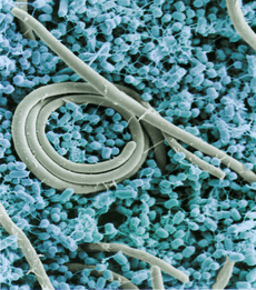 Salmonella na snímku z elektronového mikroskopu dobarveném počítačem.