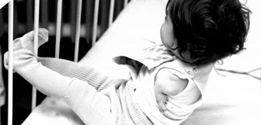 Dítě narozené bez rukou vinou účinků léku Contergan.