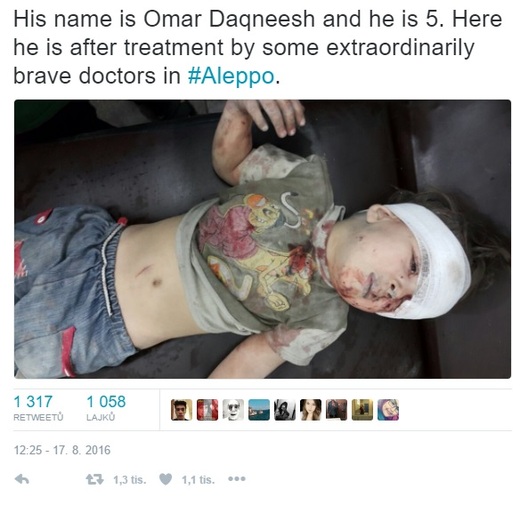 Zraněný chlapec na jednom ze snímků na Twitteru.