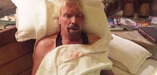 Richard Branson přežil vážnou cyklistickou nehodu.