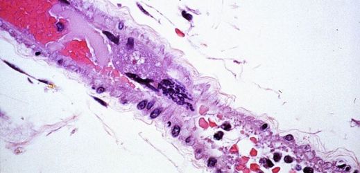 Lidská tkáň pod mikroskopem. 