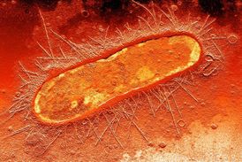 Zánět močových cest způsobuje především bakterie E. coli.
