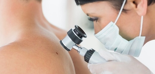 Nová metoda může pomoci s léčbou rakoviny kůže.