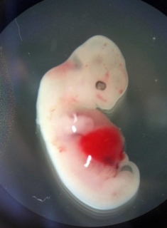 Embryo prasete a člověka.