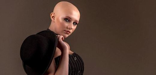 Patnáctiletá dívka s alopecií chce svými fotografiemi inspirovat lidi se stejným onemocněním, aby se nestyděli za svůj vzhled.