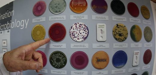 Příklady bakterií jako E.cola (ilustrační foto).