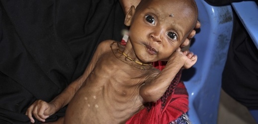 Hladomor v Somálsku (ilustrační foto).