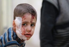 Civilní oběť bojů v Sýrii.