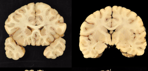 Mozek (ilustrační foto).