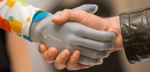 Bionická protéza Touch Bionics.