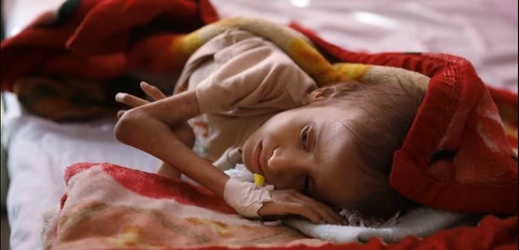 Jemenské dítě.