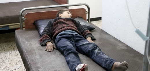 Dítě zraněné při útoku ve východní Ghútě. 